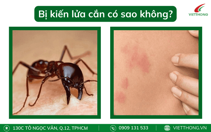 Bị kiến lửa cắn có sao không?