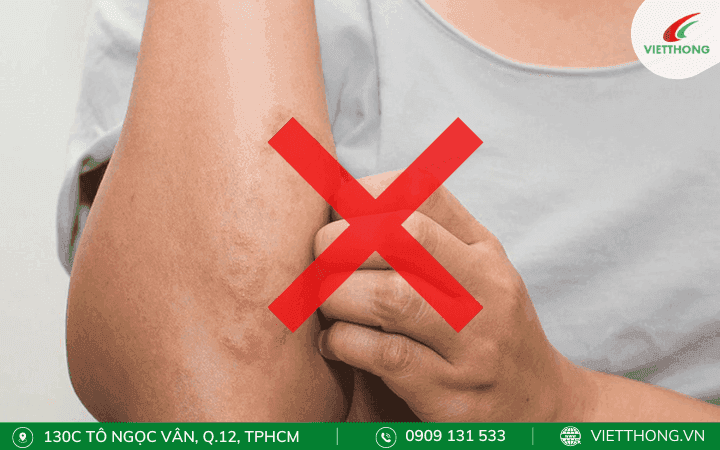 Một số lưu ý khi chữa kiến ba khoang cắn tại nhà