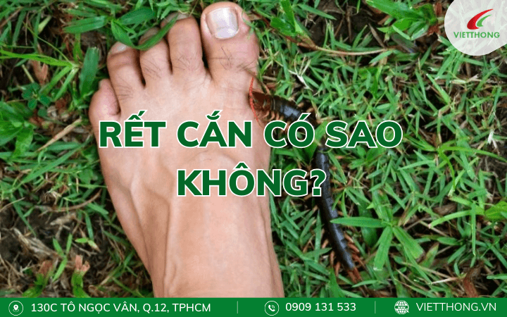 Bị rết cắn có sao không