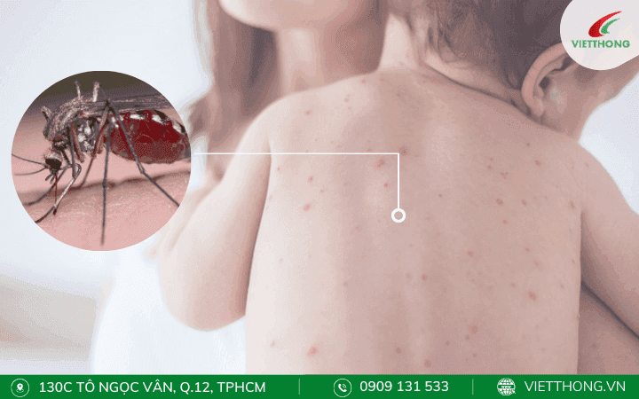 Muỗi vằn nguồn lây truyền bệnh sốt xuất huyết con đường lây truyền bệnh sốt xuất huyết