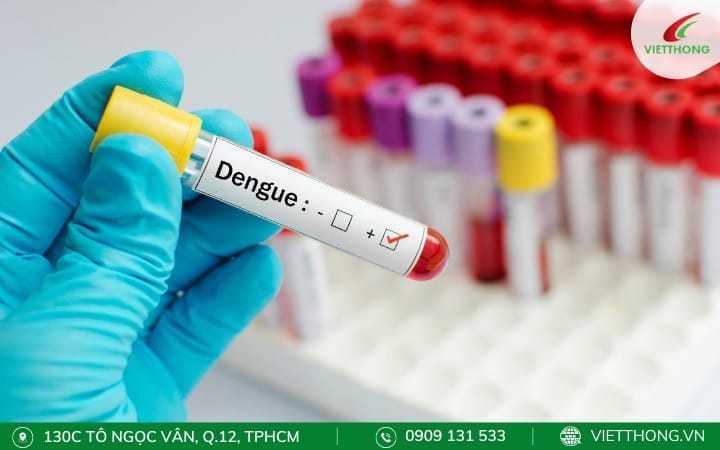 Chẩn đoán virus dengue Chẩn đoán virus dengue